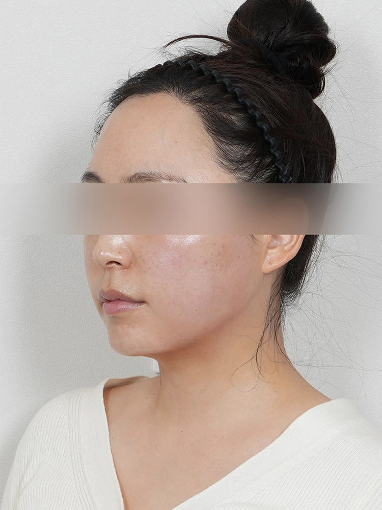 Case 2 After
