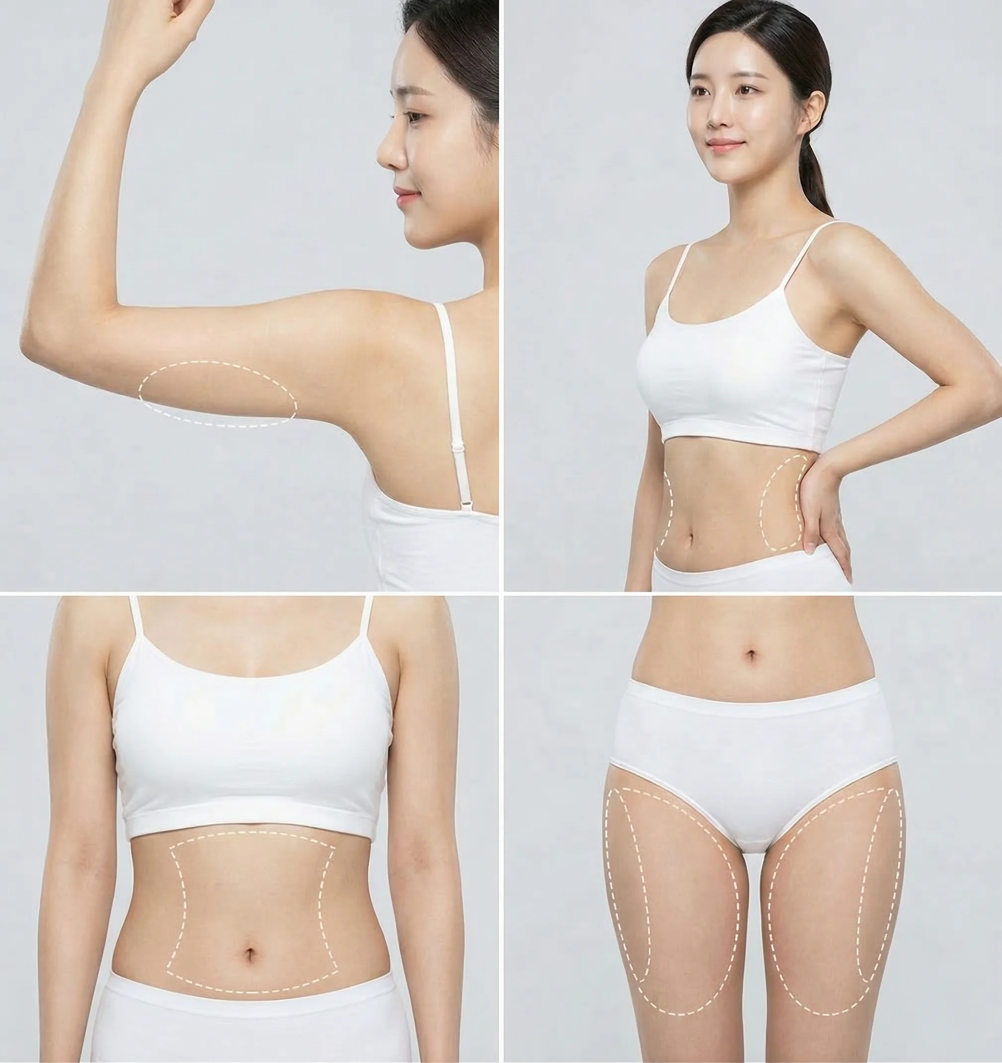 바디 온다리프팅 시술 가능한 부위