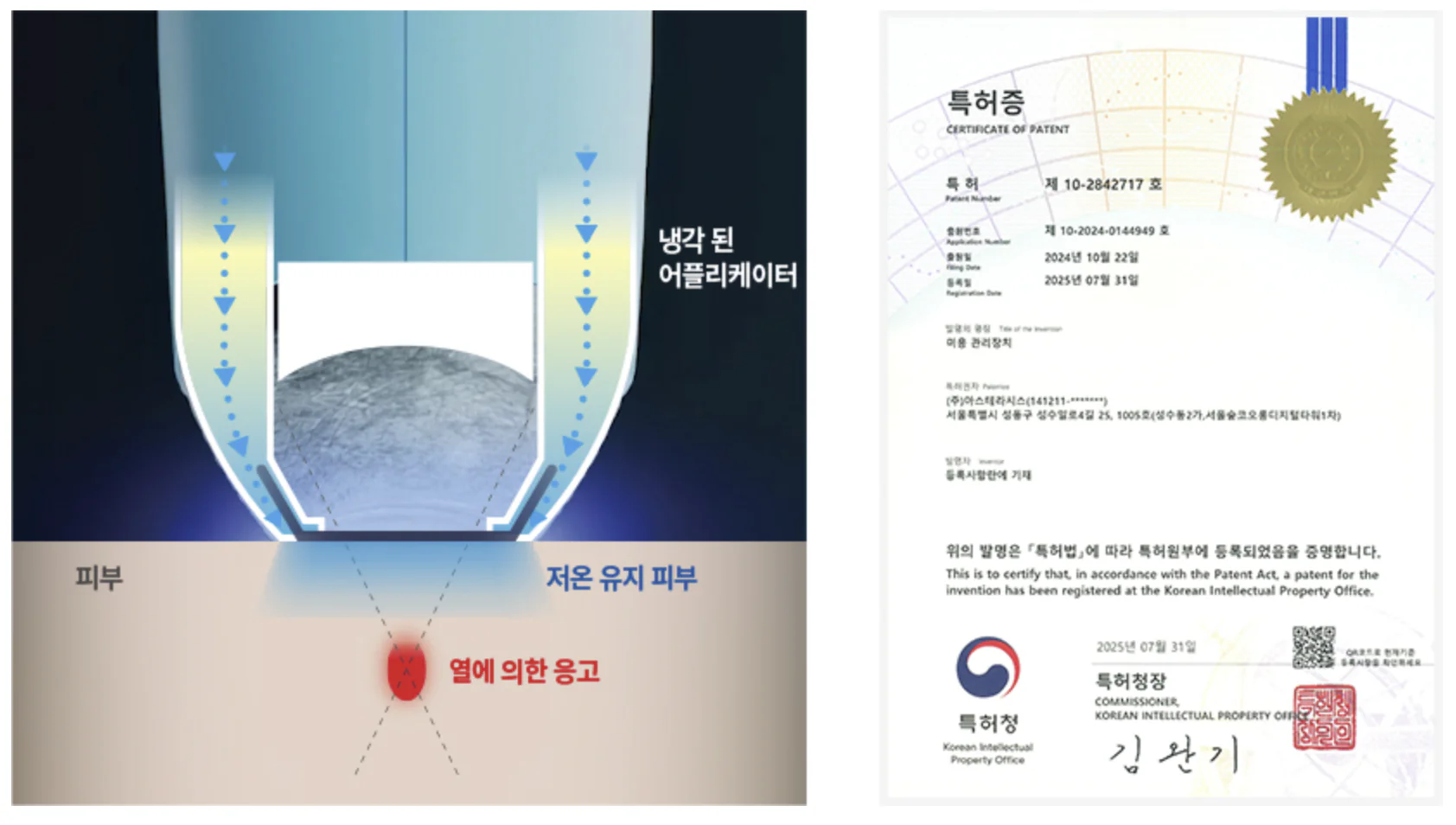 쿨소닉의 표피 냉각 원리