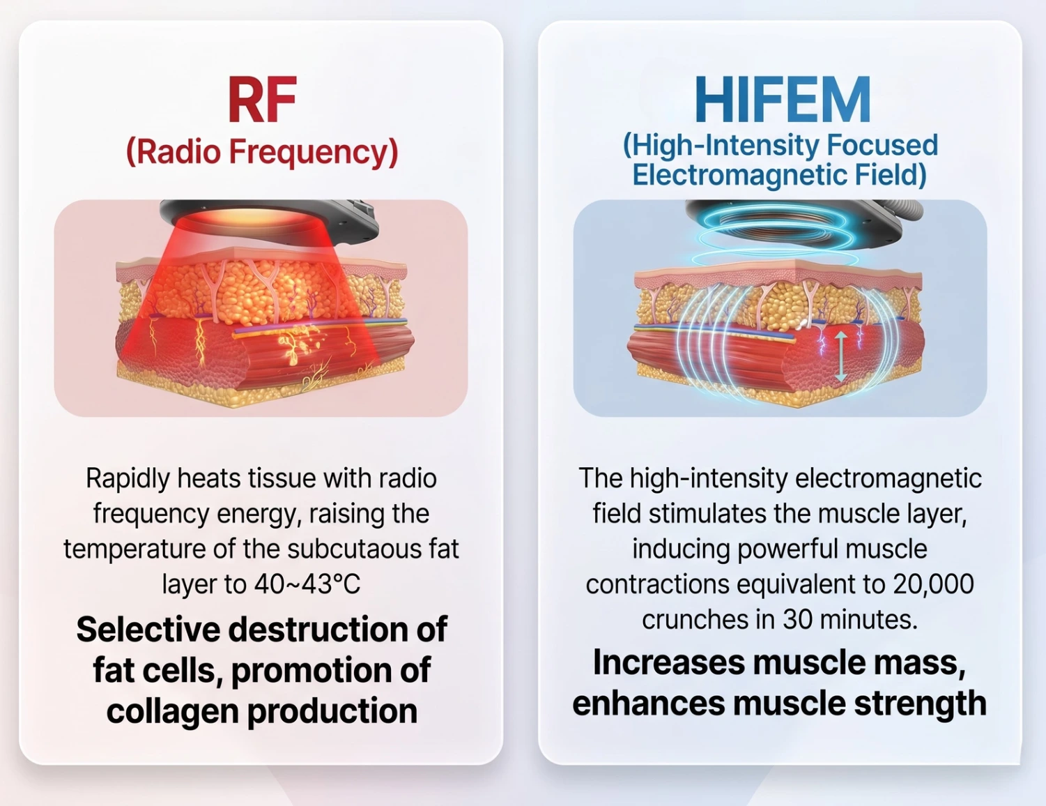 엠스컬프네오의 두 가지 원리 : 고주파와 HIFEM
