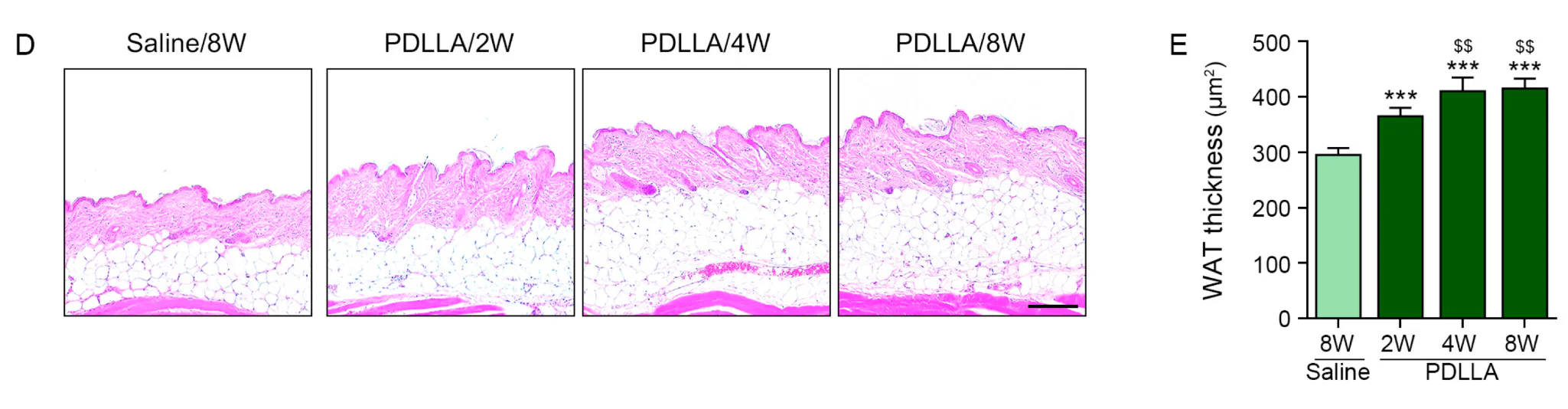 쥬베룩볼륨 주입 후 피하지방층의 두께 변화에 대한 논문 자료
