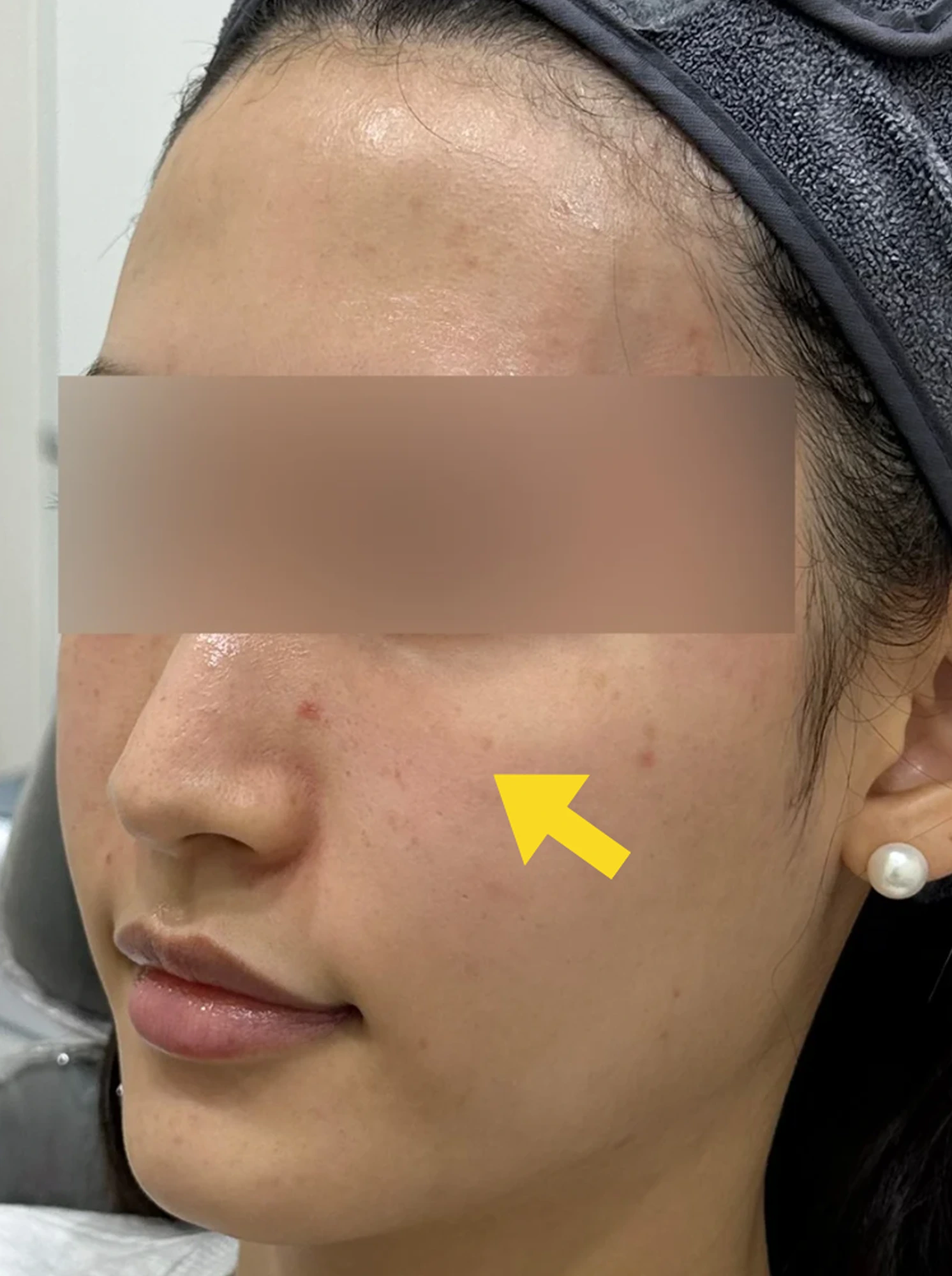 Case 1 After