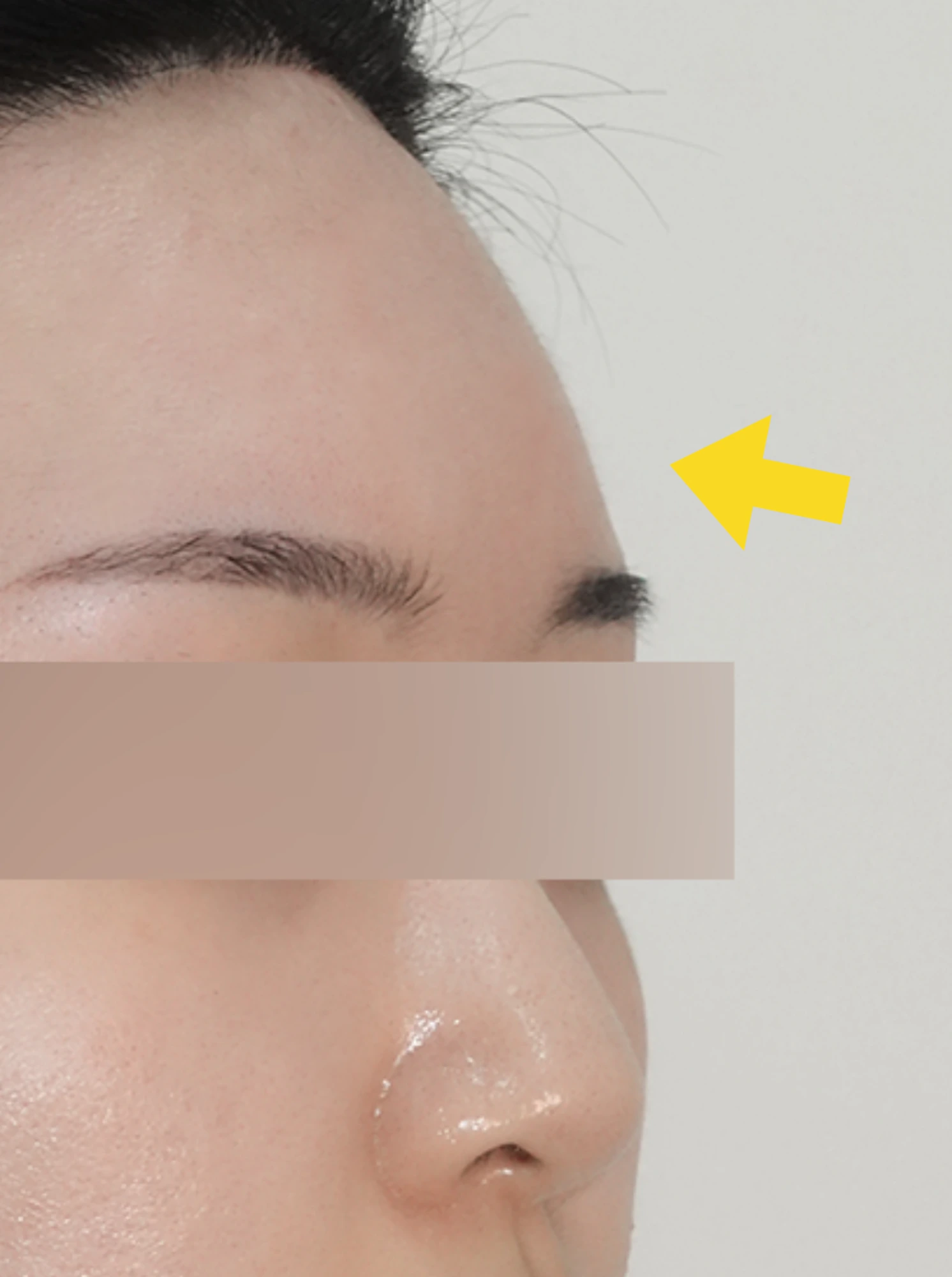 Case 2 After