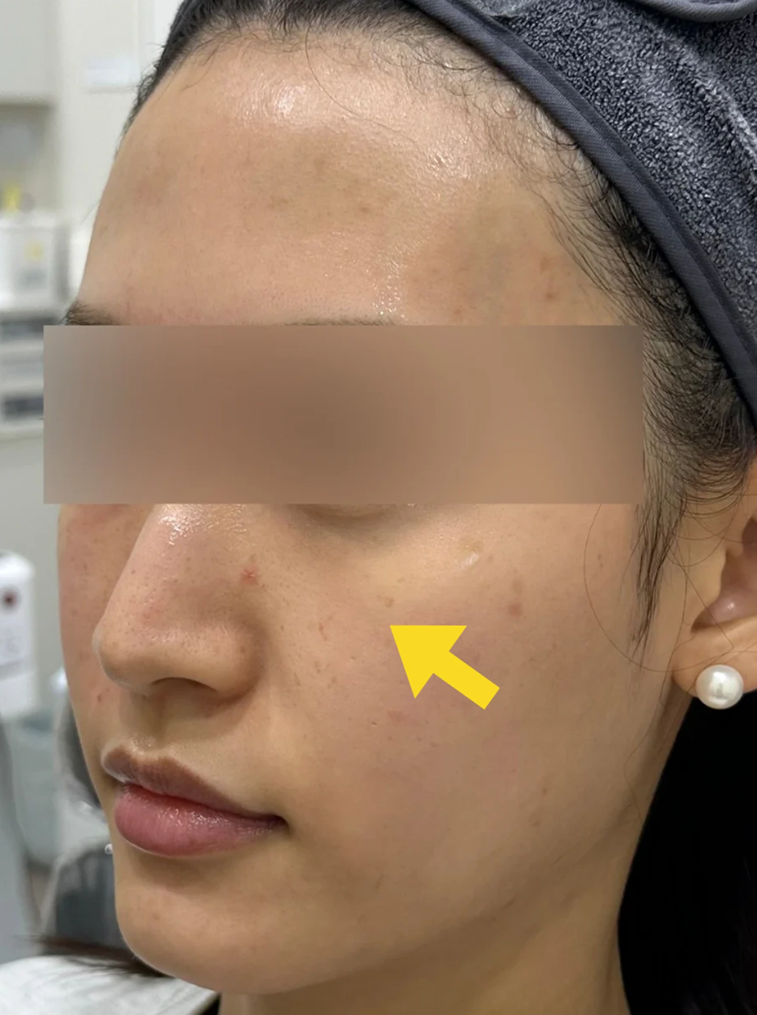 Case 1 Before