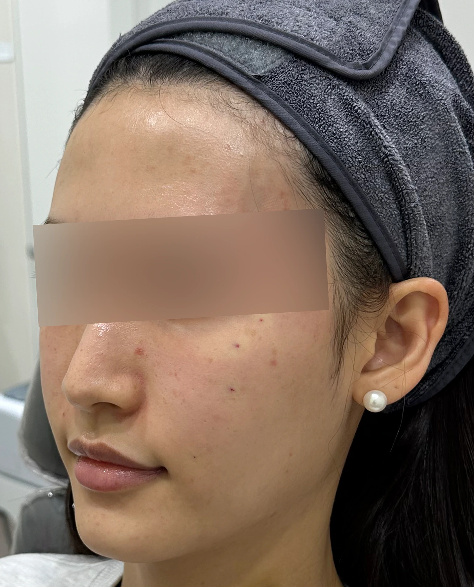 Case 1 After