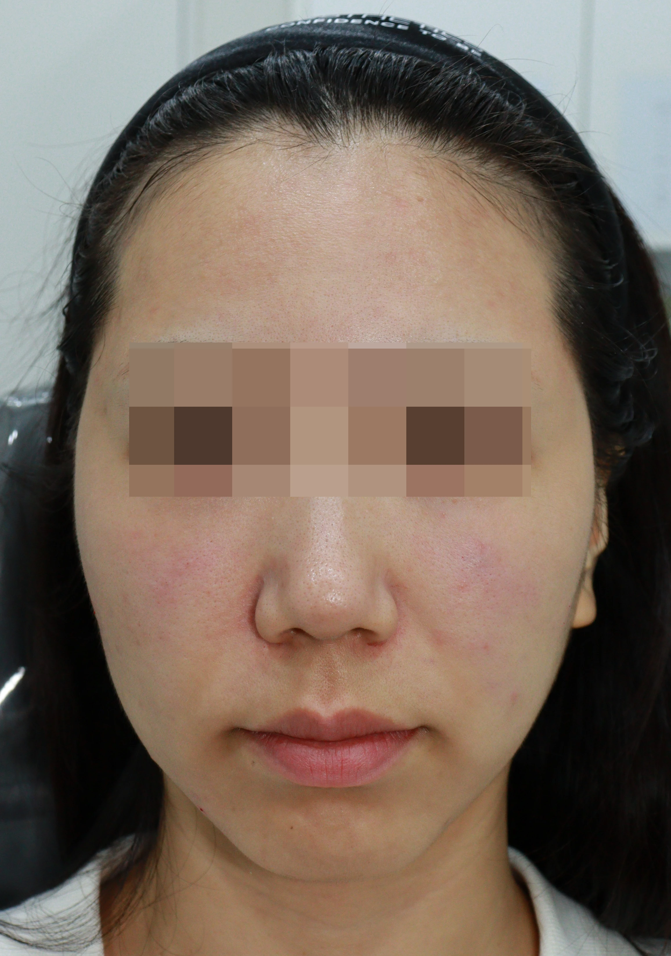 Case 2 After