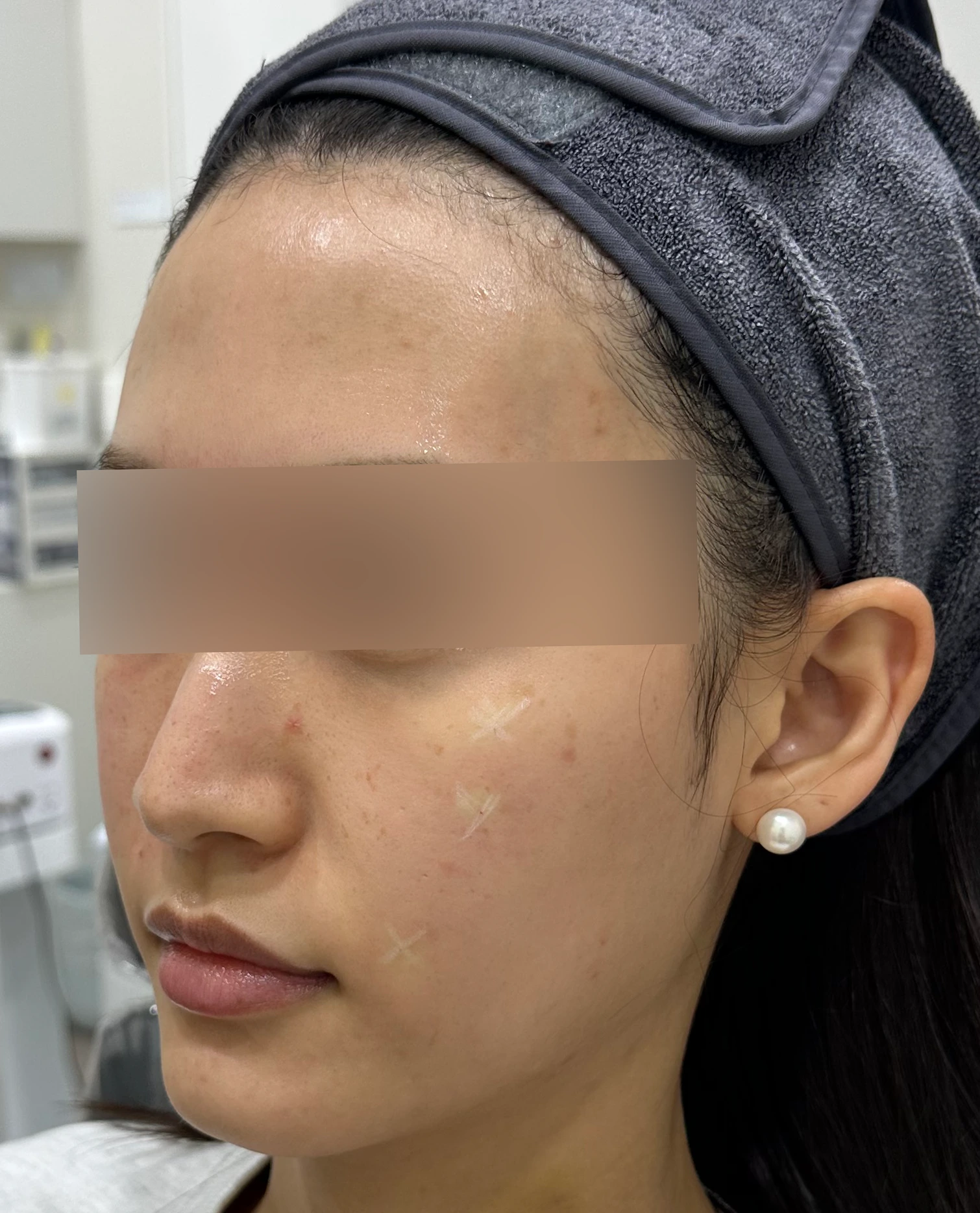 Case 1 Before