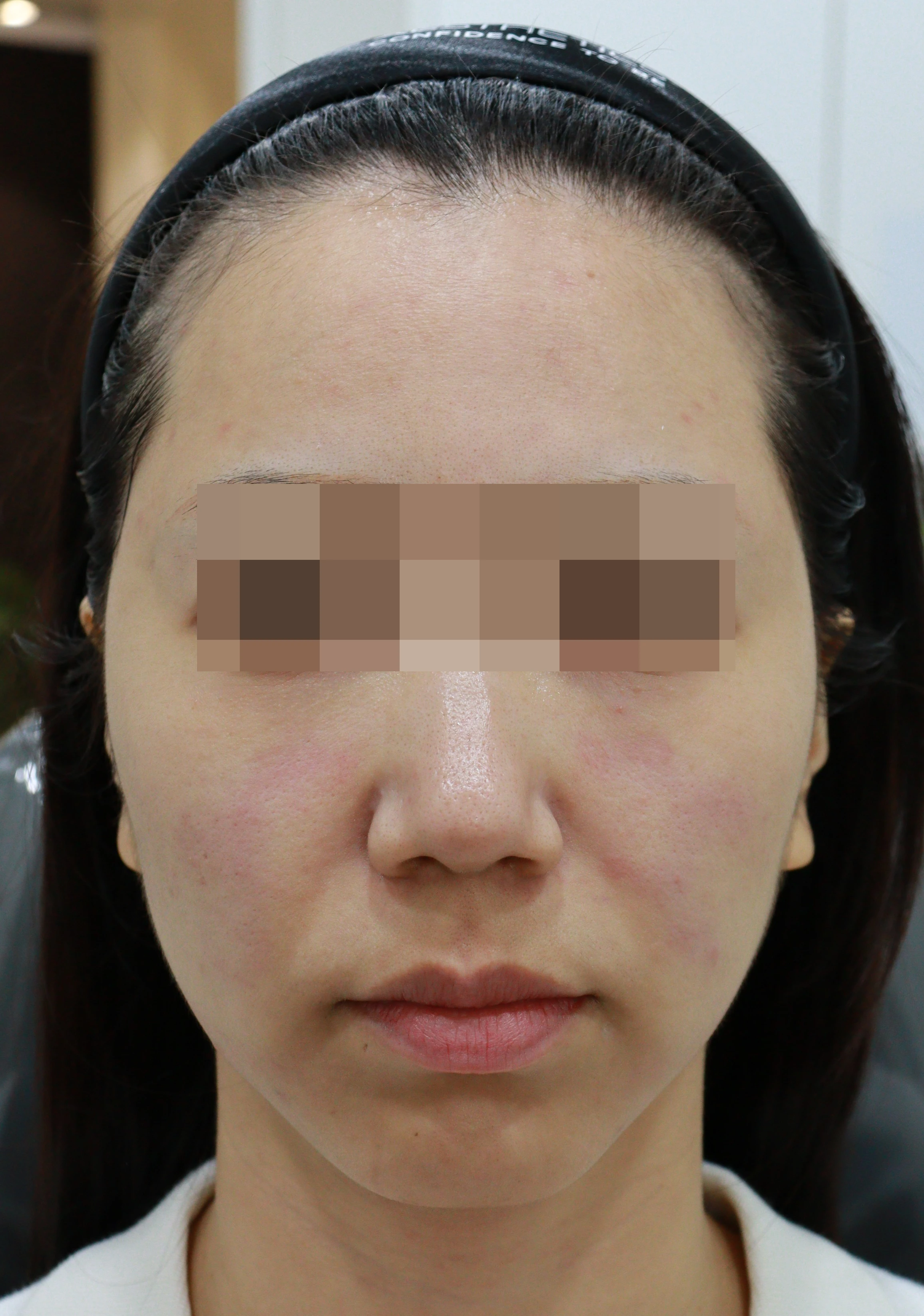 Case 2 Before