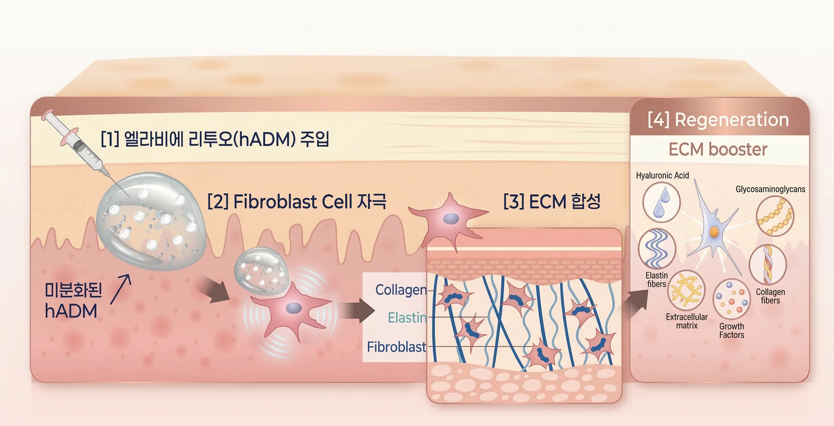 리투오 시술 후 섬유아세포가 ECM을 합성하는 과정