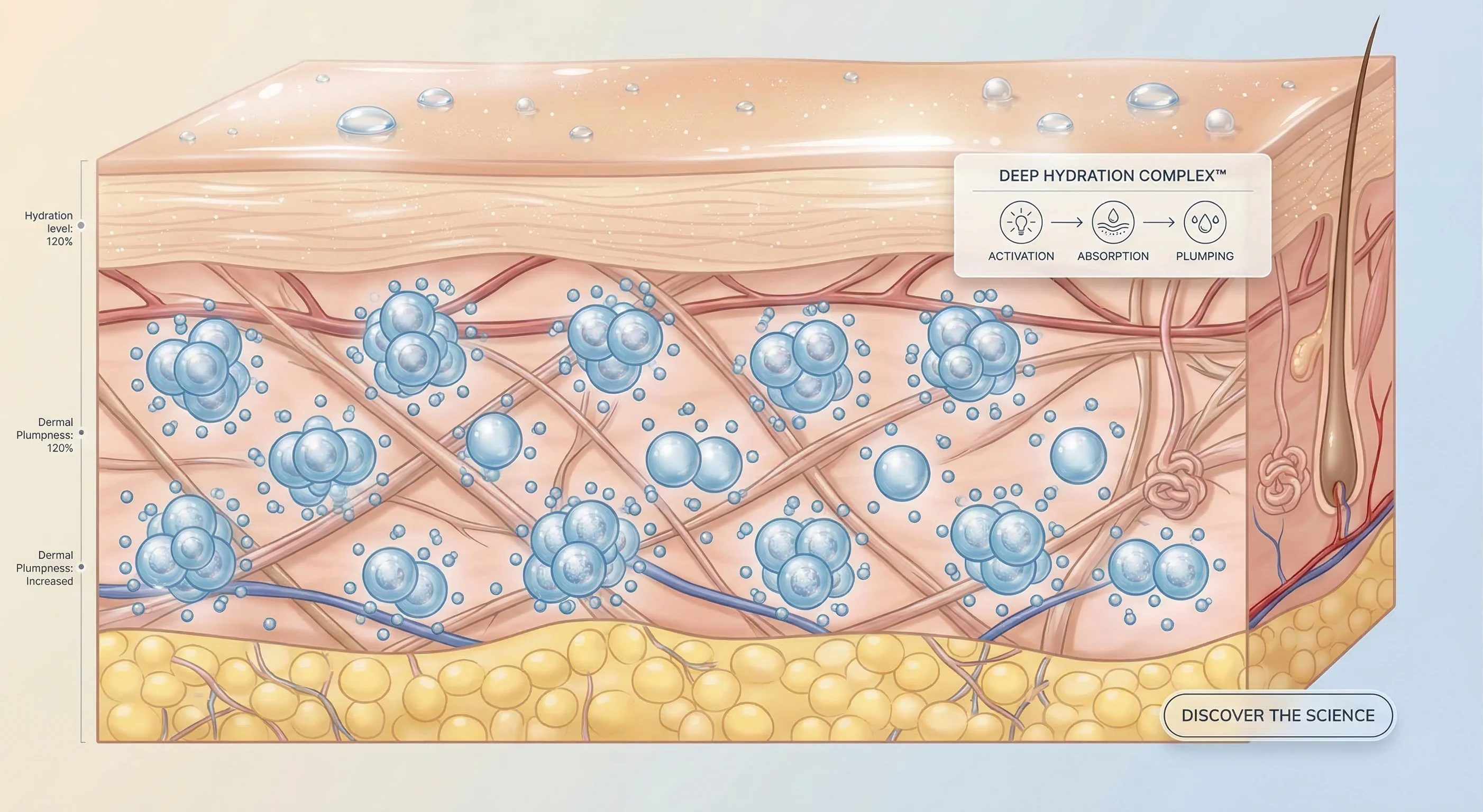 스킨바이브 등 히알루론산 제제가 진피 내부에 주입된 모식도