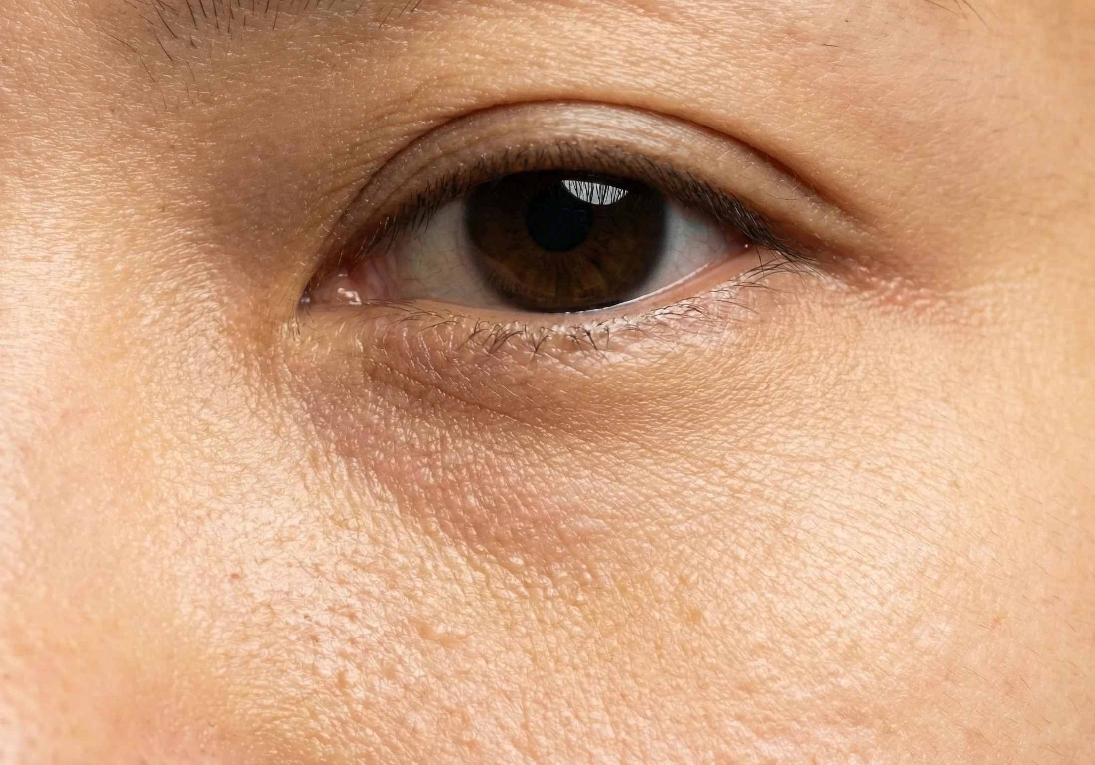 아시아 여성의 눈밑 꺼짐 예시 이미지